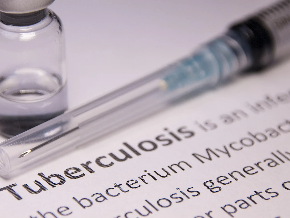 <div class="paragraphs"><p>Common myths and facts about TB</p></div>
