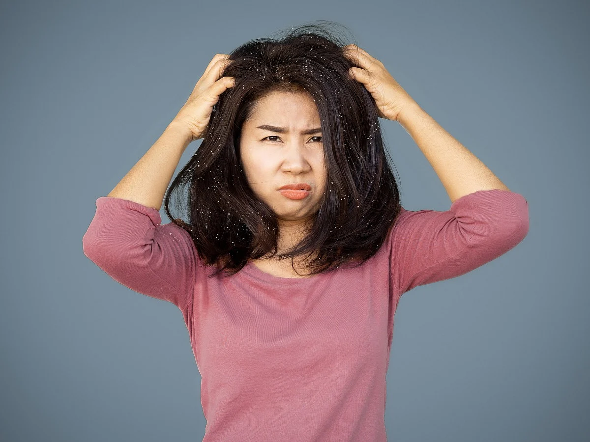 <div class="paragraphs"><p>Know all about&nbsp;Scalp Yeast Infection</p></div>