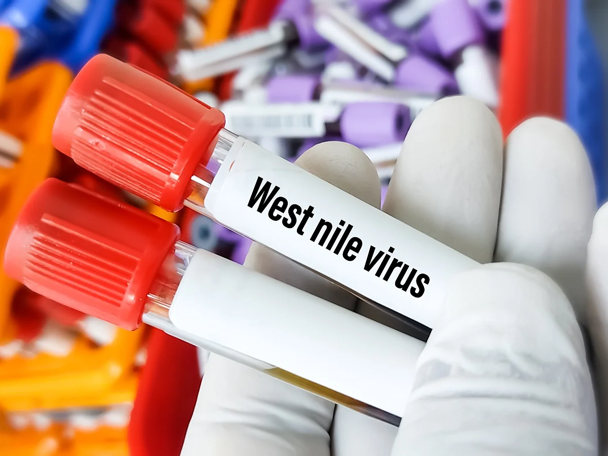 <div class="paragraphs"><p>All you need to know about&nbsp;West Nile Virus</p></div>