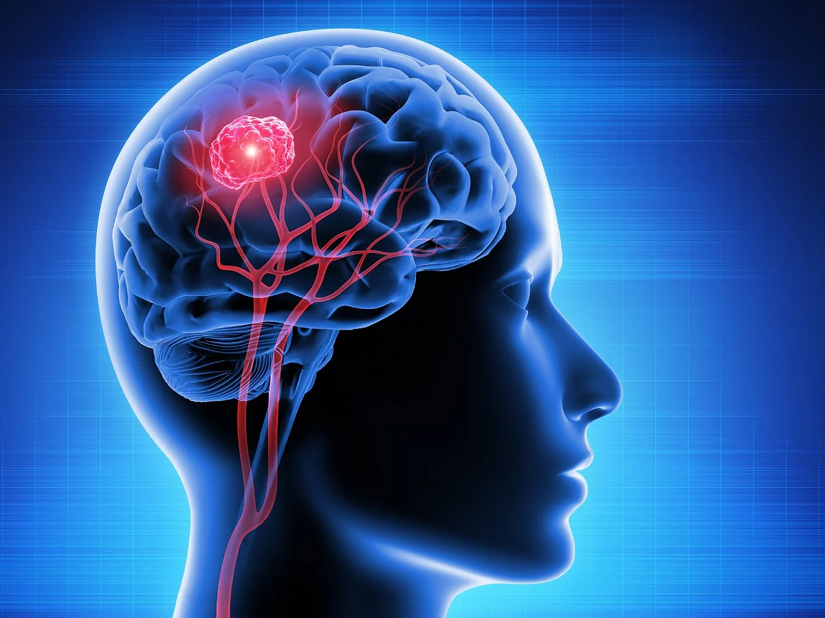 <div class="paragraphs"><p>Know all about&nbsp;Brain Tumor</p></div>