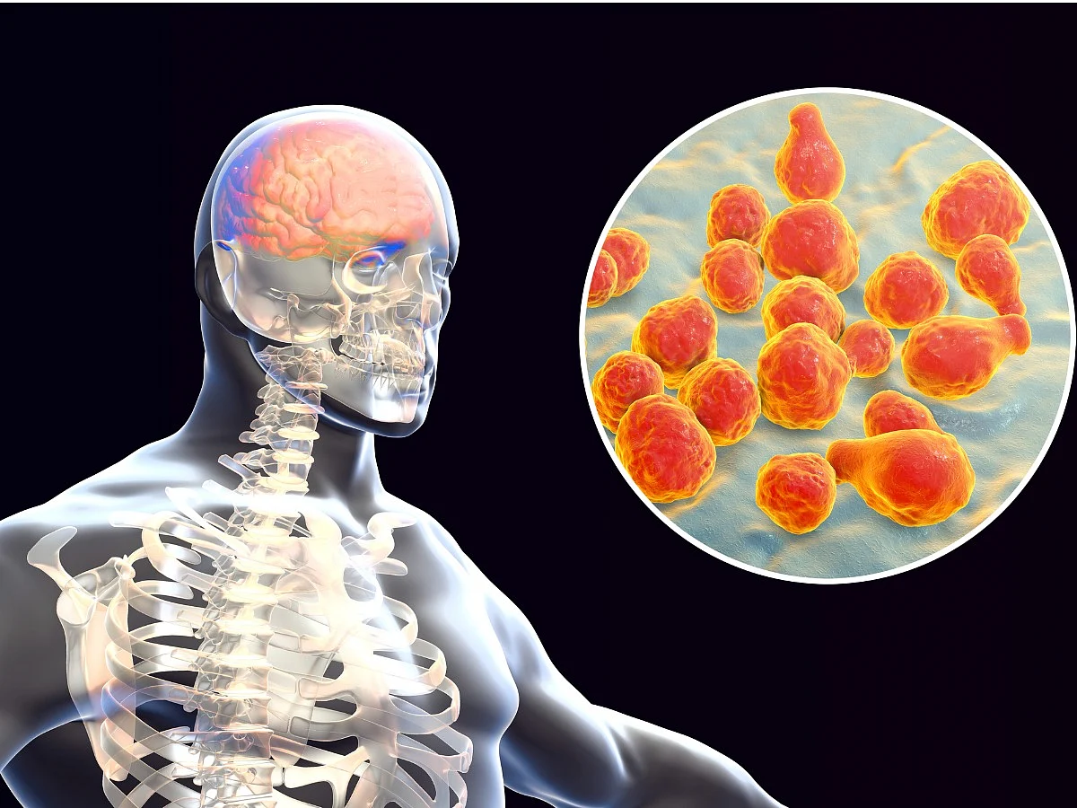 <div class="paragraphs"><p>All you need to know about&nbsp;Fungal Meningitis</p></div>