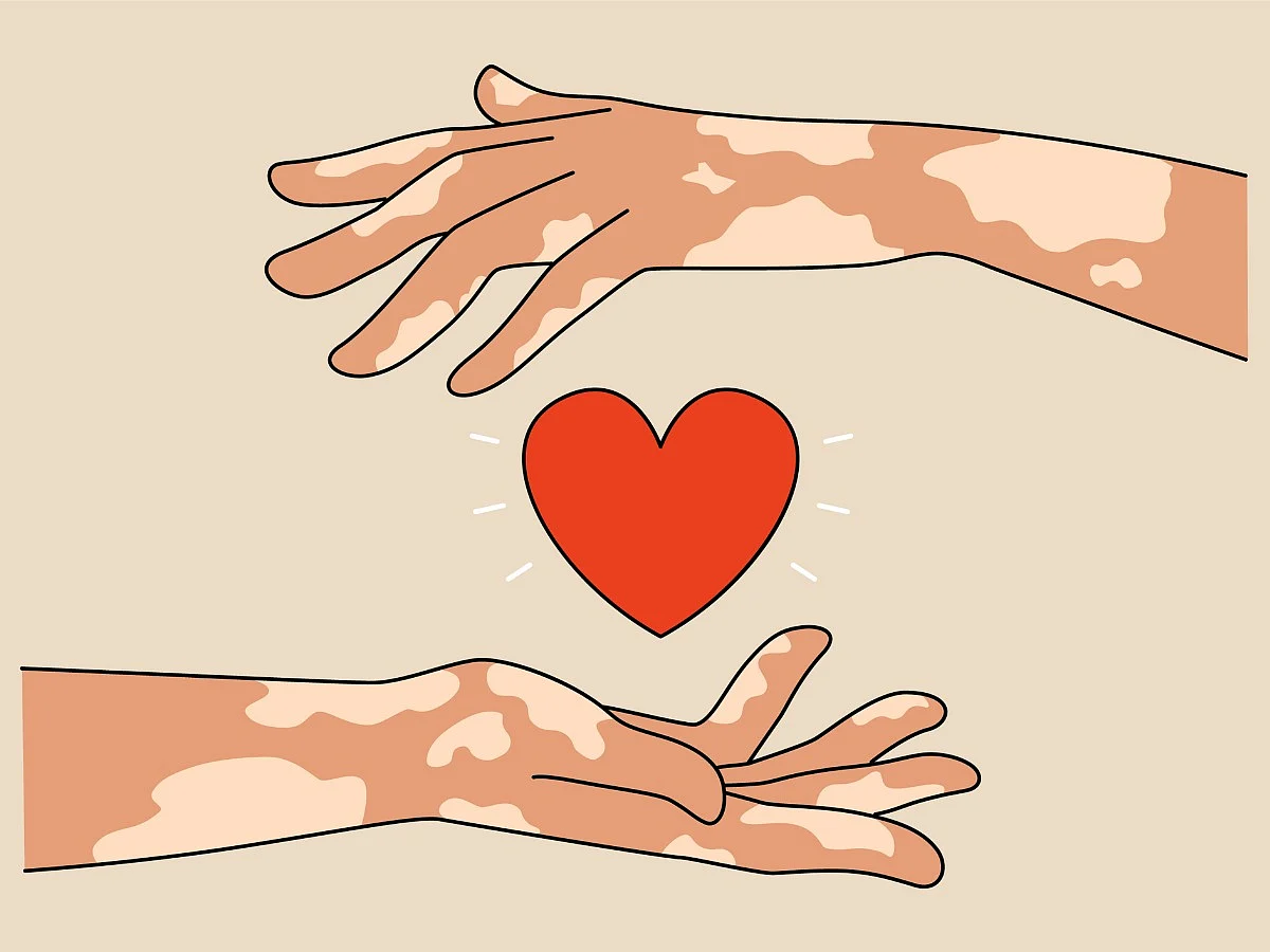 <div class="paragraphs"><p>Myths about Leprosy Debunked</p></div>