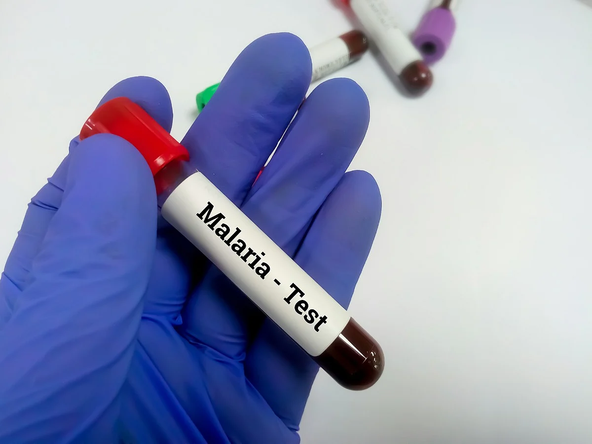 <div class="paragraphs"><p>Tips to Prevent  Malaria</p></div>