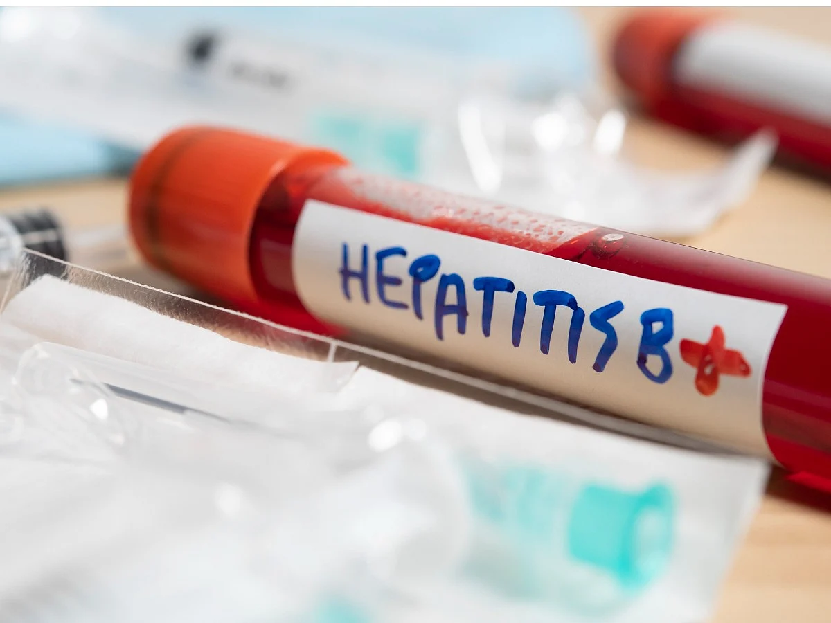 <div class="paragraphs"><p>Know warning symptoms of Hepatitis B</p></div>