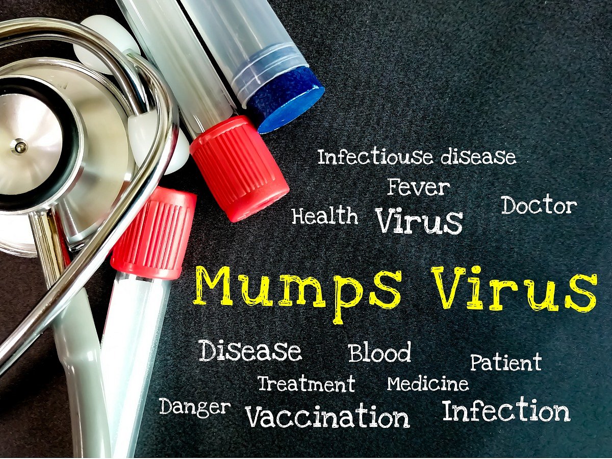 <div class="paragraphs"><p>how to prevent mumps from spreading</p></div>