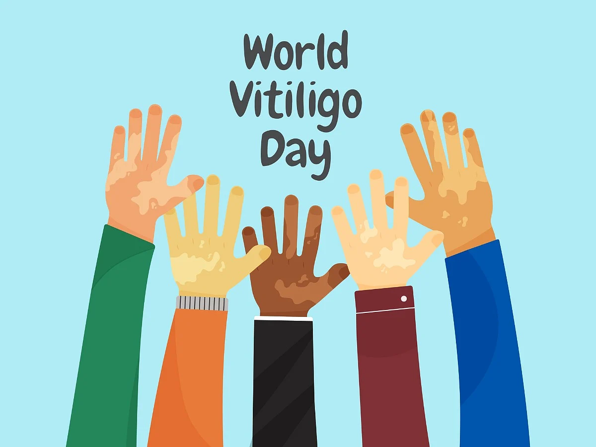 <div class="paragraphs"><p>5 Tips To Manage &amp; Control Vitiligo</p></div>