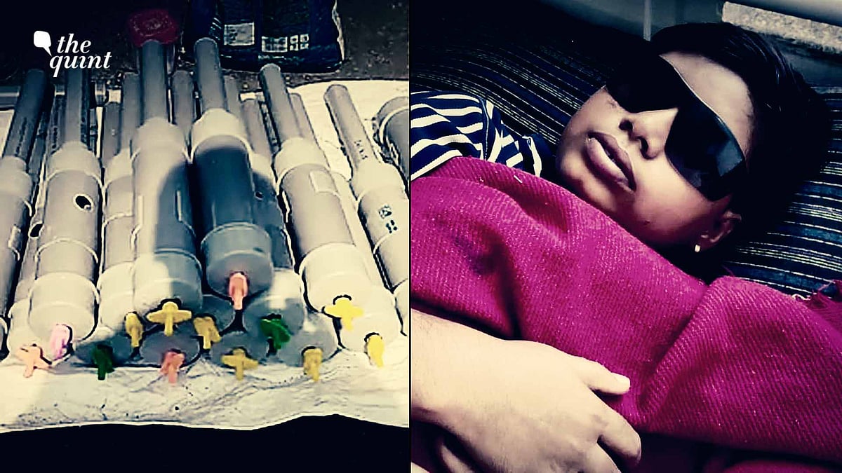 <div class="paragraphs"><p>An 11-year-old victim of carbide gun injury recuperates in Madhya Pradesh. Scores were injured or blinded by exploding carbide guns this Diwali season in Madhya Pradesh.</p></div>