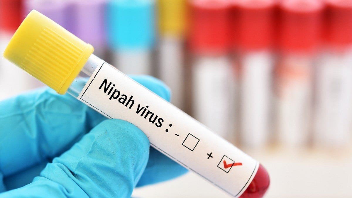 <div class="paragraphs"><p>Know everything about Nipah Virus Infection</p></div>
