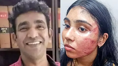 assault case