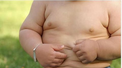 Obesity