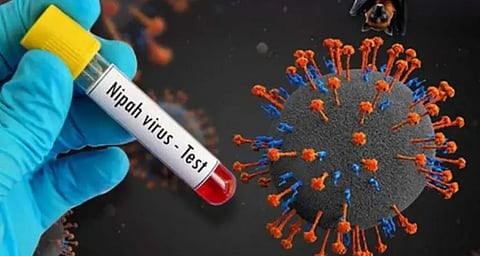 nipah  virus