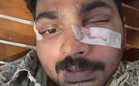 Bus : 'ബസിലെ ACക്ക് തണുപ്പ് അത്ര പോരാ..' : പുലർച്ചെ ഒന്നരയ്ക്ക് ക്ലീനർക്ക് ക്രൂര മർദ്ദനം