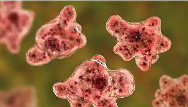 amoebic encephalitis