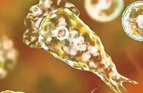 Amoebic encephalitis confirmed in Kochi, Lakshadweep native undergoing treatment