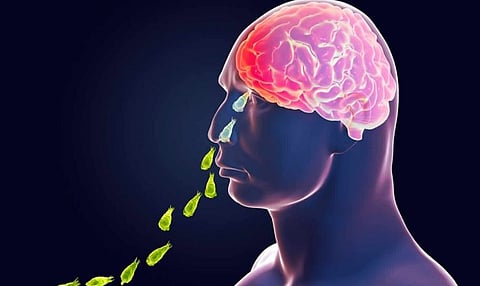 amoebic meningoencephalitis