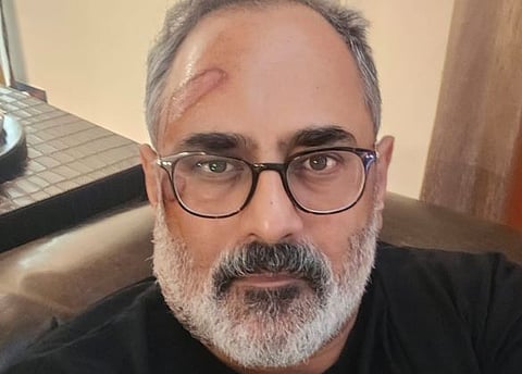 Rajeev Chandrsekhar : 'ട്രെഡ് മിൽ ചെയ്യുമ്പോൾ മൊബൈൽ ഫോൺ ജാഗ്രതയോടെ മാത്രം ഉപയോഗിക്കുക':  BJP സംസ്ഥാന അധ്യക്ഷന് പരിക്ക്