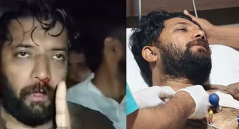 Shafi Parambil : ഷാഫിക്കെതിരായ പോലീസ് അക്രമം : 3 പോലീസുകാർക്ക് എതിരെ നടപടി ആവശ്യപ്പെട്ട് DGPക്ക് പരാതി നൽകി