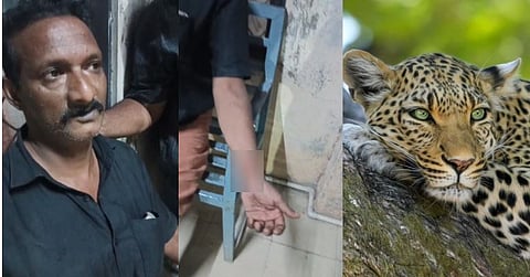 leopard attack