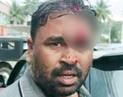 Robbed : കുടകിൽ മലയാളി വ്യവസായിയെ ക്രൂരമായി ആക്രമിച്ച് കവർച്ച