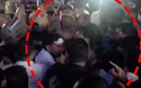 പേരാമ്പ്ര സംഘർഷം: ആരോപണ വിധേയരായ 2 DYSPമാർക്ക് സ്ഥലംമാറ്റം; പോലീസിൻ്റെ പിടിവാശിയെ പഴിച്ച് പരിക്കേറ്റ കോൺഗ്രസ് പ്രവർത്തകൻ | Perambra clash