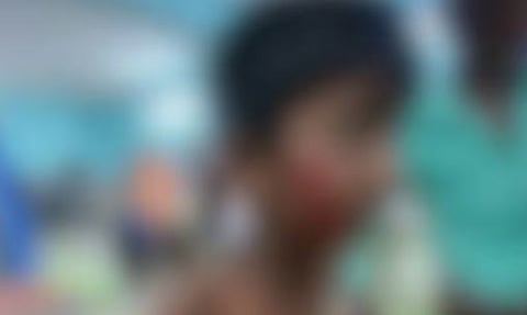 പാലക്കാട് രണ്ടാം ക്ലാസ്സുകാരനും യുവതിക്കും തെരുവു നായയുടെ കടിയേറ്റു | Stray dog