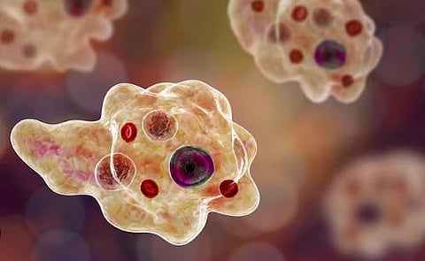 Amoebic Encephalitis