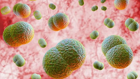 amoebic meningoencephalitis