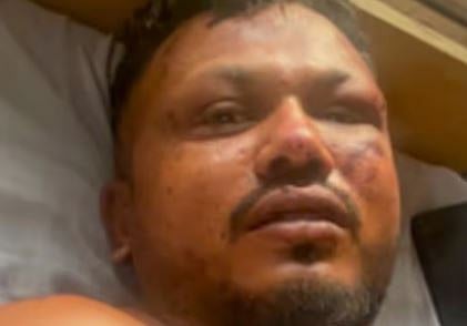 'ഭാര്യയോടും മകനോടും സംസാരിക്കുന്നില്ല, ഒറ്റയ്ക്ക് ഇരിക്കാനാണ് ഇഷ്ടം': അഹമ്മദാബാദ് വിമാന ദുരന്തത്തിൽ നിന്ന് രക്ഷപ്പെട്ട ഒരേയൊരു വ്യക്തിയുടെ നിലവിലെ അവസ്ഥ.. | Ahmedabad plane crash