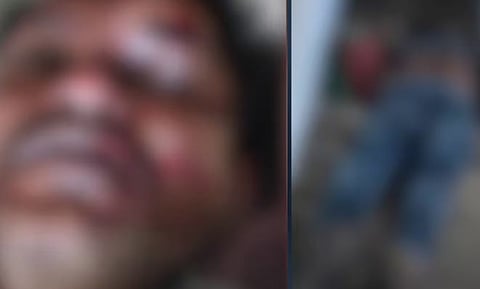 പരിയാരം മെഡിക്കൽ കോളേജിൽ രോഗിയുടെ കൂട്ടിരിപ്പുകാരൻ കോണിപ്പടിയിൽ നിന്ന് വീണ് മരിച്ചു | Patient