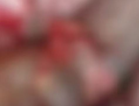 കിടപ്പു രോഗിയായ വീട്ടമ്മയെ കടിച്ച തെരുവ് നായക്ക് പേവിഷബാധ സ്ഥിരീകരിച്ചു: വീട്ടമ്മയുടെ നില ഗുരുതരം, ജാഗ്രതാ നിർദ്ദേശം | Stray dog