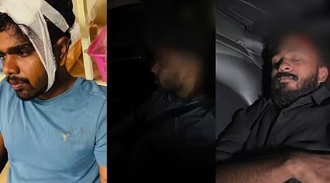 കാലിക്കറ്റ് യൂണിവേഴ്‌സിറ്റി ഹോസ്റ്റലിൽ SFI -UDSF സംഘർഷം: 2 UDSF പ്രവർത്തകർക്ക് പരിക്ക് | SFI