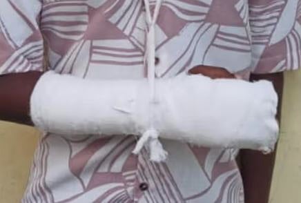 KSRTC ബസിൻ്റെ വാതിലിൽ കുടുങ്ങി ഏഴാം ക്ലാസ് വിദ്യാർത്ഥിയുടെ കൈ വിരൽ ഒടിഞ്ഞു തൂങ്ങി: സാരമായി പരിക്കേറ്റിട്ടും വഴിയിൽ ഇറക്കി വിട്ടതായി പരാതി | KSRTC