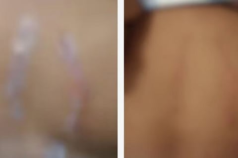 12 വയസ്സുകാരനെ ക്രൂരമായി മർദിച്ചു, തല ഭിത്തിയിൽ ഇടിപ്പിച്ചു, ദേഹമാസകലം മുറിവ് : അമ്മയും ആൺസുഹൃത്തും അറസ്റ്റിൽ | Beaten