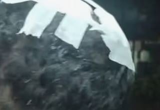 100 രൂപയുടെ തർക്കം: കോഴിക്കോട് യുവാവിന് കുത്തേറ്റു; കേസ് | Stabbed