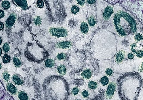 എത്യോപ്യയെ വലച്ച് മാരകമായ മാർബർഗ് വൈറസ്: 88% വരെ മരണനിരക്ക്; ലോകാരോഗ്യ സംഘടനയുടെ മുന്നറിയിപ്പ് | Marburg virus