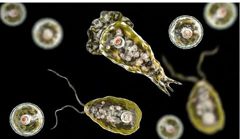 amebic meningoencephalitis