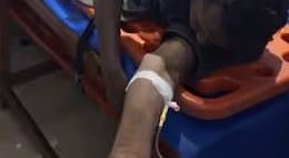 നിലമ്പൂരിൽ കരടിയുടെ ആക്രമണം: പരിക്കേറ്റയാൾ ആശുപത്രിയിൽ | Bear