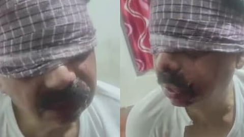 മുഖത്തും ശരീരത്തും മുറിവുകൾ, കൈകൾ കെട്ടി, കണ്ണുകൾ മൂടി: പ്രവാസി വ്യവസായിയെ തട്ടിക്കൊണ്ട് പോയ സംഭവത്തിൽ ദൃശ്യങ്ങൾ പുറത്ത് | Kidnapping