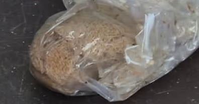 പ്രസവത്തിനെത്തിയ യുവതിയുടെ ശരീരത്തിൽ 75 ദിവസം കോട്ടൺ തുണി മറന്നു വച്ച സംഭവം : DMO അന്വേഷണത്തിന് ഉത്തരവിട്ടു | DMO