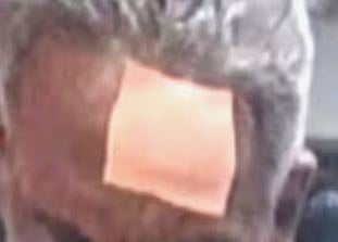 മണ്ണഞ്ചേരിയിൽ കോൺഗ്രസ് ഗ്രൂപ്പ് പോര്: കസേരയേറിൽ മുൻ ബ്ലോക്ക് പ്രസിഡൻ്റിന് പരിക്ക് | Congress