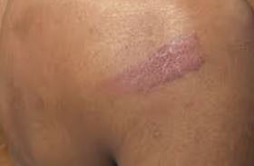 യുവാവിനെ മർദ്ദിച്ചെന്ന പരാതി വ്യാജമെന്ന് പോലീസ്: മെഡിക്കൽ രേഖകൾ പുറത്തുവിട്ടു | Police