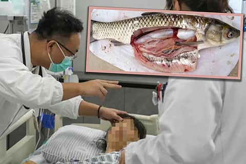 തലവേദന മാറാൻ മീനിന്റെ പിത്താശയം പച്ചയ്ക്ക് വിഴുങ്ങി; യുവതിയുടെ കരളിനും വൃക്കയ്ക്കും തകരാർ, ഒടുവിൽ ഐ.സി.യുവിൽ | Fish gallbladder poisoning China

