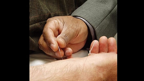 A practitioner inserting thin acupuncture needles into a patient’s wrist during a treatment session.