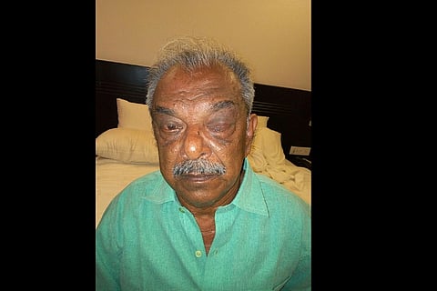  76-year-old man and family in Andaman await justice after alleged attack by army officer 
