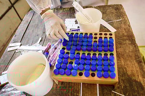 COVID-19 test kit