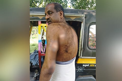 Chandra Babu who got injured