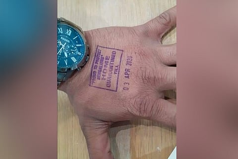 Karnataka to put indelible ink stamp on palm of passengers under quarantine