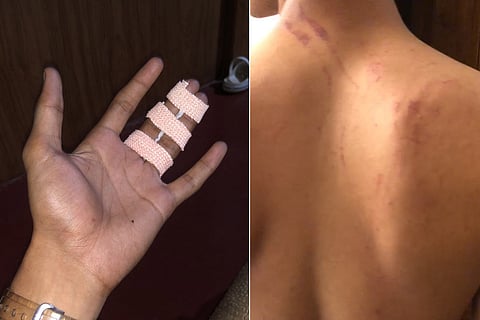 Kerala college student Nihal who was brutally ragged