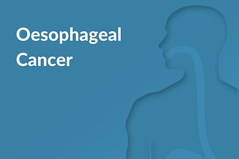 Persistent cough, difficulty swallowing? Be wary of oesophageal cancer