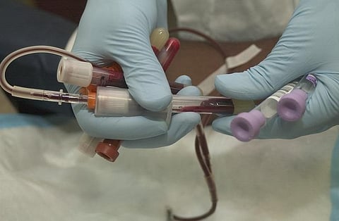 From Karnataka to Myanmar: 2 units of rare blood group saves woman